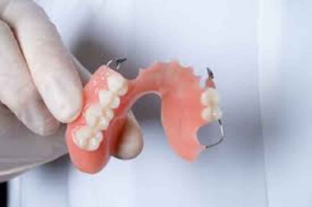 How Long Do Acrylic Dentures Last? CraftersMag