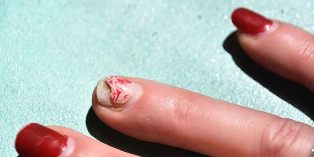 Why Do My Acrylic Nails Keep Popping Off?
