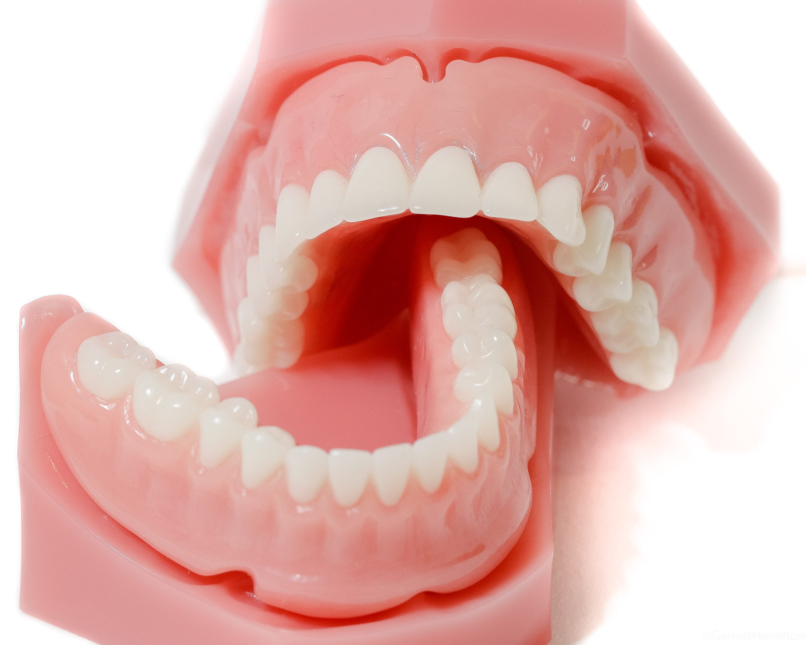 Are Acrylic Dentures Good? CraftersMag