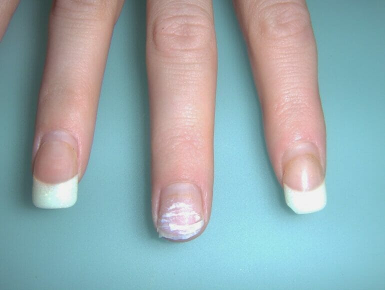 Can You Put Acrylic On Exposed Nail Bed ? CraftersMag