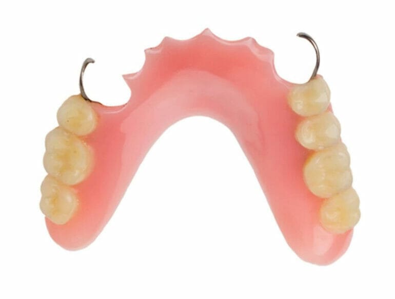 are acrylic dentures good