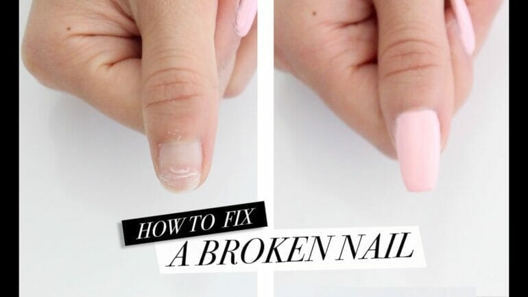 how to treat a broken nail under acrylic
